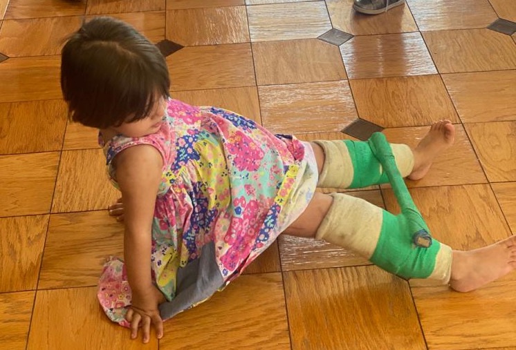 A four-year-old girl, abandoned on a trash heap with two broken legs, recovers at a protection unit.